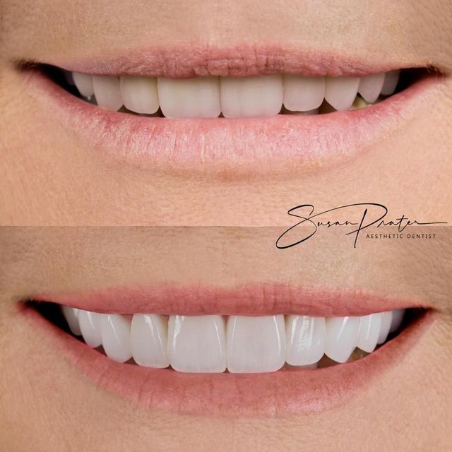 Smile Gallery | Cre8 Smile Studio Jacksonville, FL